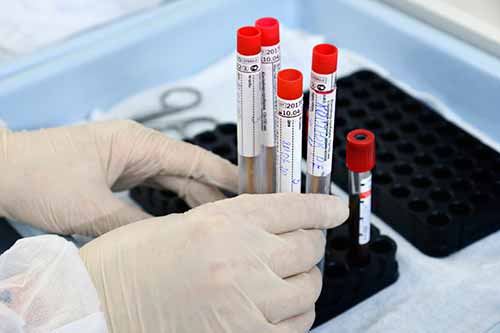  На Полтавщині 301 новий випадок <b>коронавірусу</b>. П'ятеро з них у Гребінківському районі 