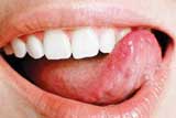  Язик як дзеркало організму 