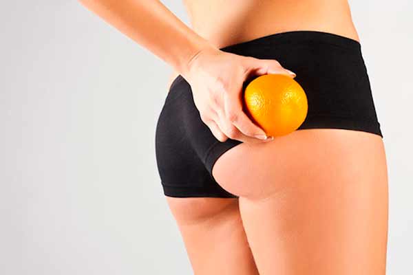 7 міфів про целюліт