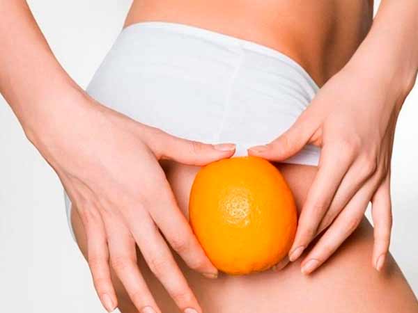 Міф 2: Целюліт виникає в певному віці