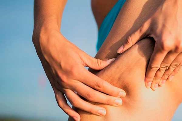 7 міфів про целюліт