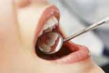  Пародонтоз - хвороба, що позбавляє зубів 