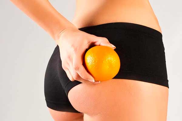 Які чинники провокують розвиток целюліту