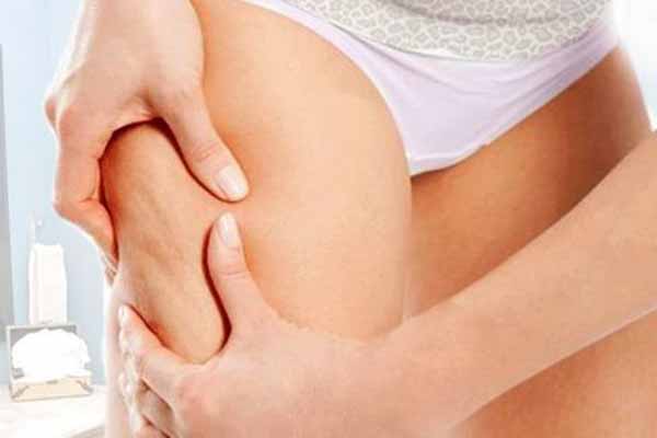 Антицеллюлитный массаж Антицеллюлитный массаж