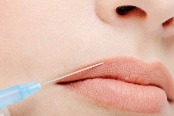 Как увеличить губы с помощью инъекций
